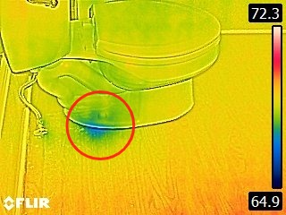 toilet anomaly